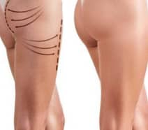 Slider image (5) Clinic Turkey